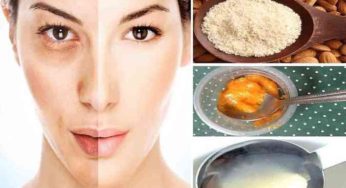 How To Remove Pigmentation From Face Permanently at Home