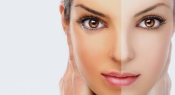 How to Choose the Right Skin Whitening Cream?