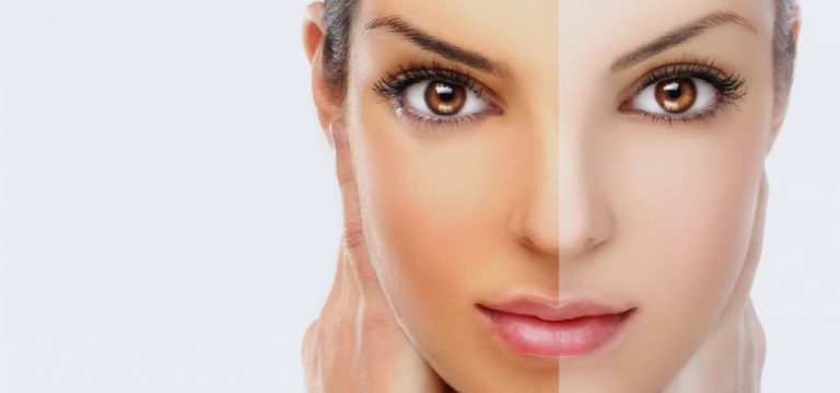 How to Choose the Right Skin Whitening Cream?