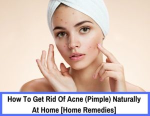 20+ Natural Proven Way to Get Rid Of Acne Overnight - Beauty And ...