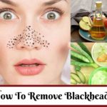 How-To-Remove-Blackheads