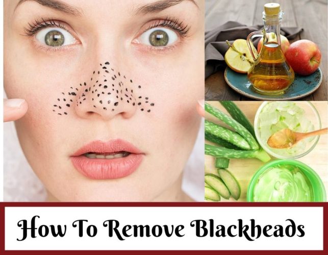 How-To-Remove-Blackheads