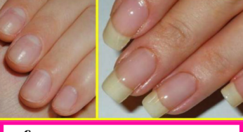 How To Grow Nails Faster At Home In One Week?