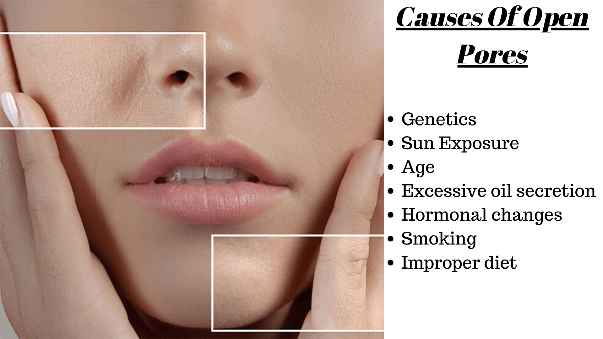 causes for open pores