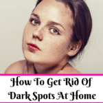 How To Get Rid Of Dark Spots