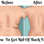 How To Get Rid Of Back Fat