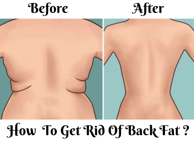 How To Get Rid Of Back Fat