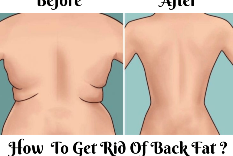 How To Get Rid Of Back Fat
