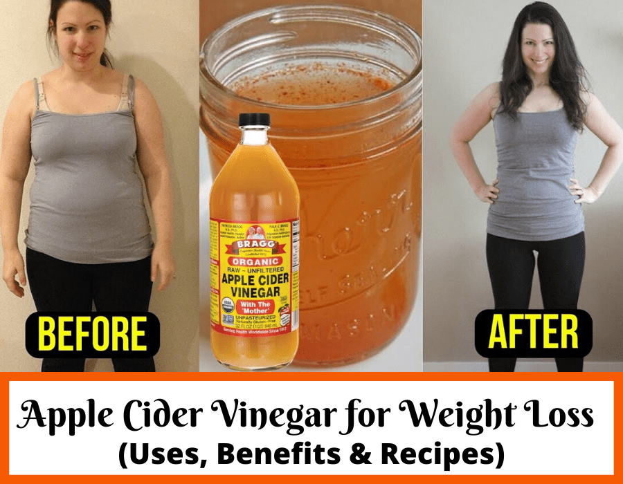 Why you Should Take Apple Cider Vinegar For weight loss ...