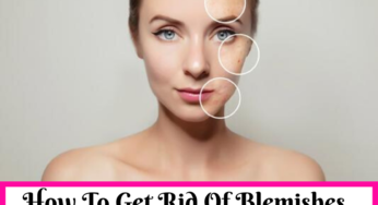 How To Get Rid Of Blemishes At Home [Home Remedies]