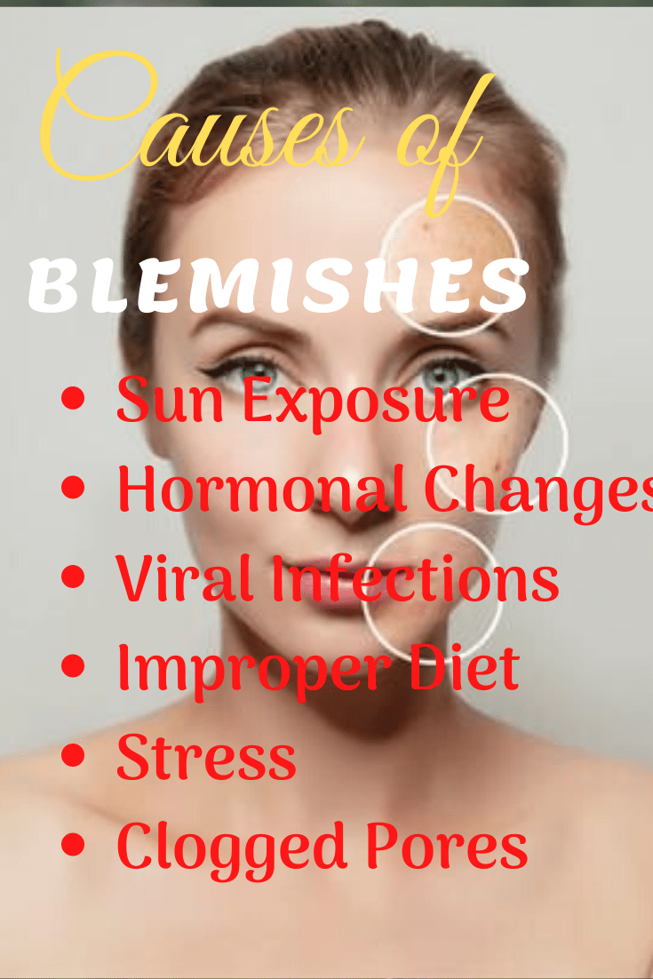 What are the Causes blemishes?