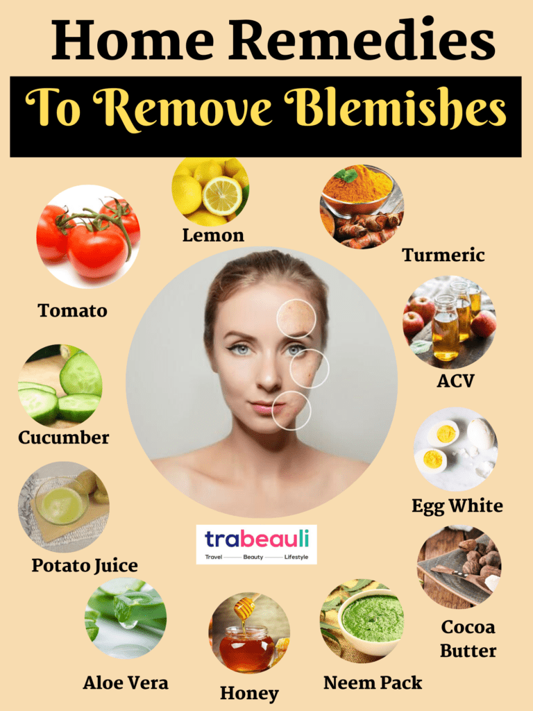 How To Get Rid Of Blemishes At Home [Home Remedies] Beauty And Lifestyle Blog