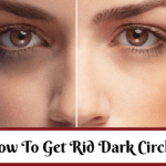 How To Get Rid Dark Circles