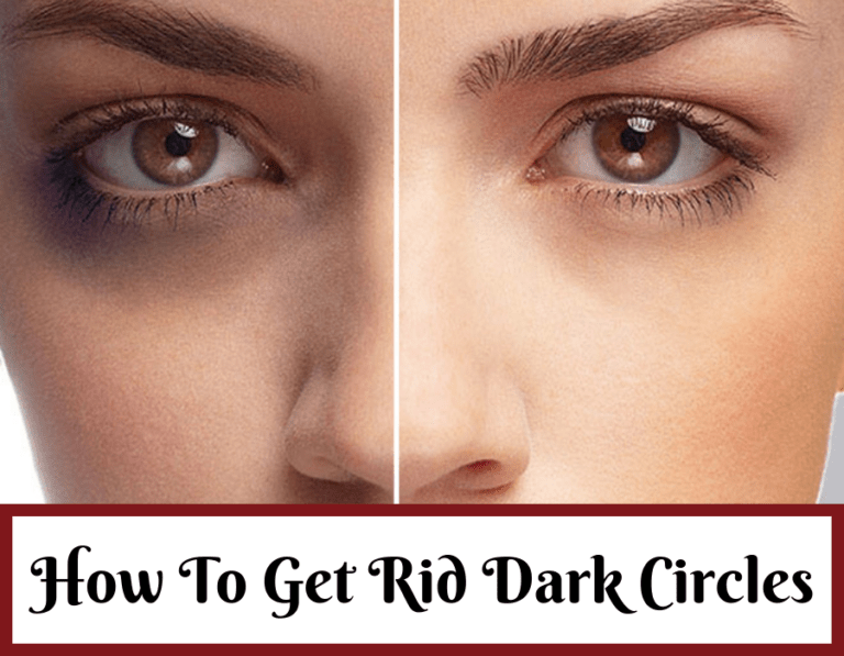 How To Get Rid Dark Circles