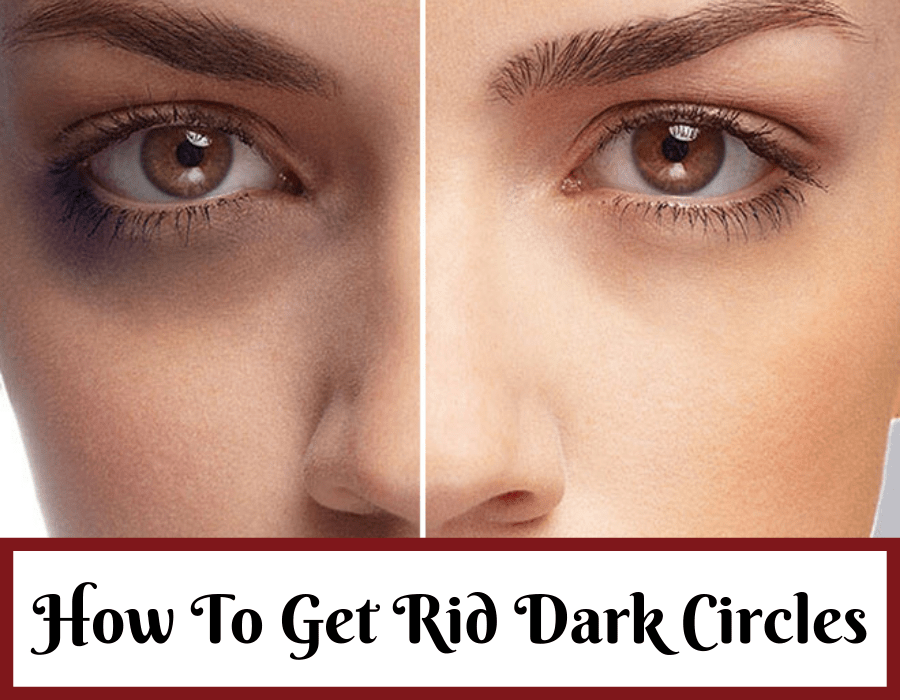 how-to-get-rid-of-dark-circles-overnight-best-remedies-for-every