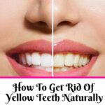 How To Get Rid Of Yellow Teeth
