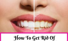 How To Get Rid Of Yellow Teeth