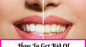 How To Get Rid Of Yellow Teeth Overnight ( At Home)