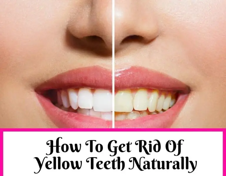 How To Get Rid Of Yellow Teeth