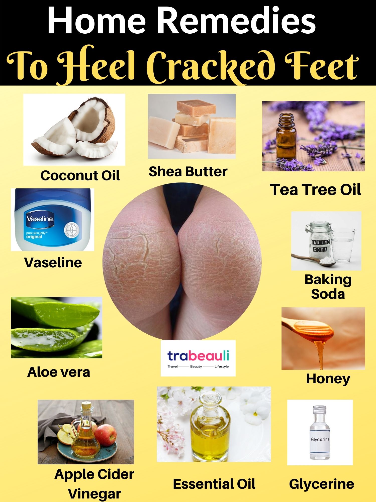 HOme Remedies To Heal cracked feet overnight at home