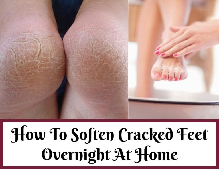 how to soften cracked feet