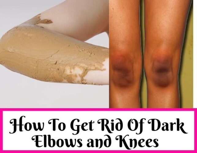 Get Rid Of Dark Elbows and Knees