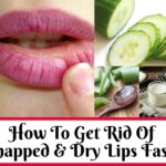 get rid of Chapped Lips fast