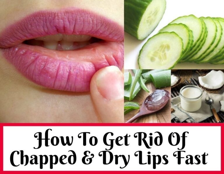 get rid of Chapped Lips fast