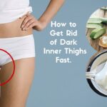 How to get rid of dark buttocks in a week