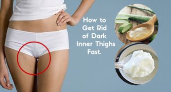 How To Get Rid of Dark Buttocks in a Week?