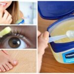 uses of vaseline
