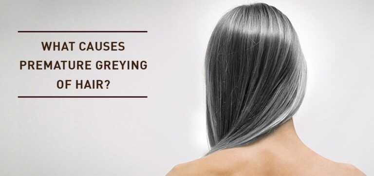 8 Tips to Stop Premature Greying of Hair