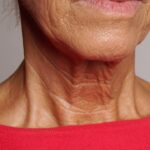 prevent-neck-wrinkles