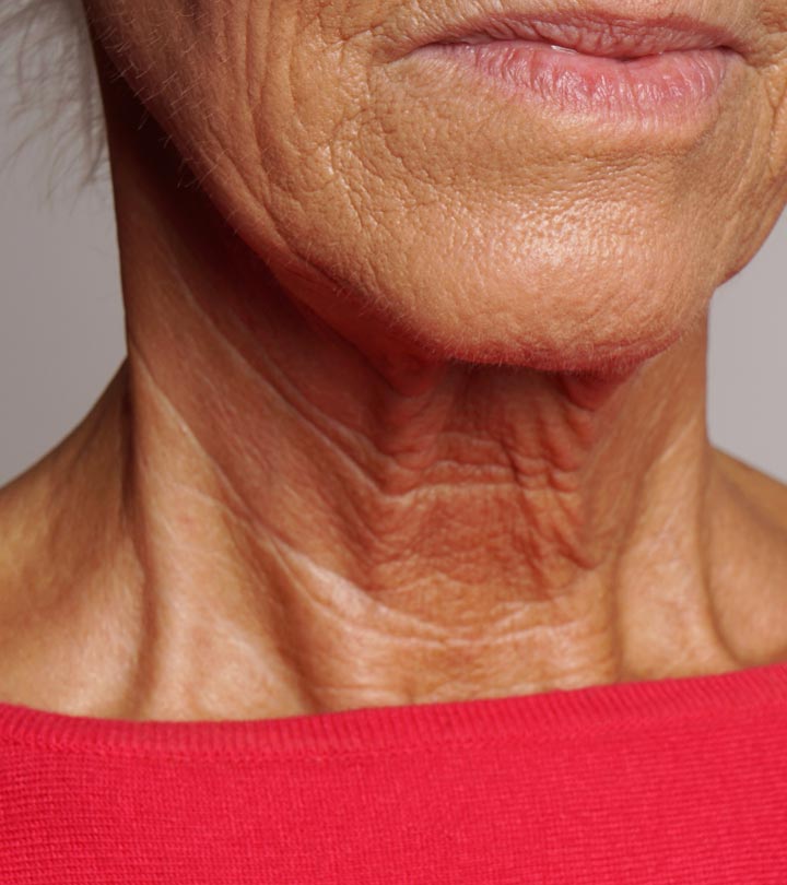 Neck Wrinkles: Causes and Ways to Prevent them