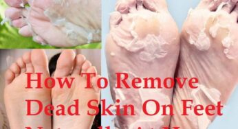 Home Remedies to Remove Dead Skin from Feet