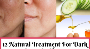 12 Best Treatment For Dark Spots (Pigmentation) On The Face