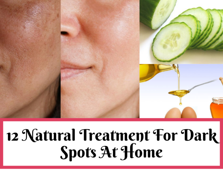 Best Treatment For Dark Spots