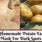 potato for dark spots