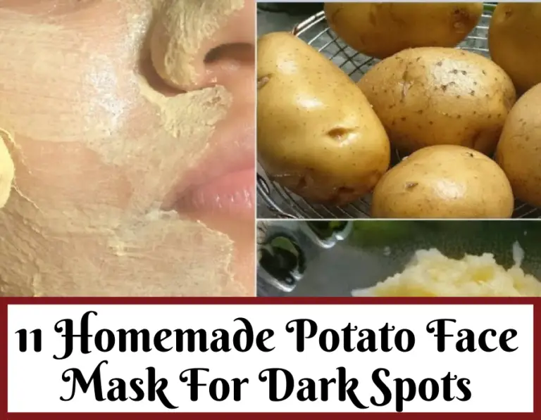 potato for dark spots