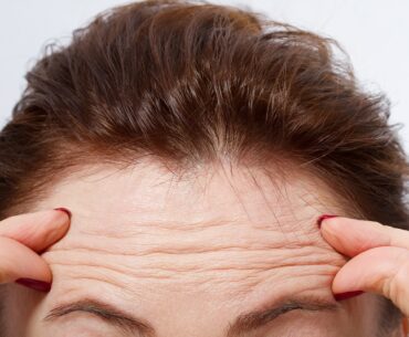 getting-rid-of-forehead-wrinkles