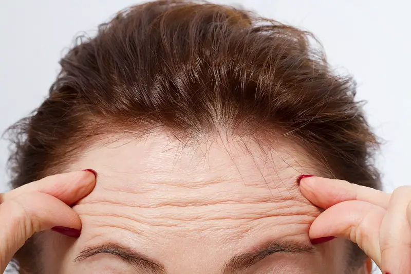 getting-rid-of-forehead-wrinkles