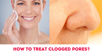 How To Treat Clogged Pores On Face At Home