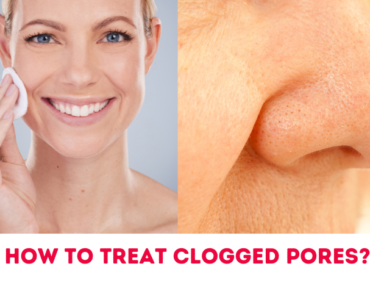 How To Treat Clogged Pores?