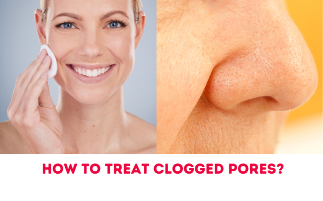 How To Treat Clogged Pores?