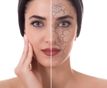 how to treat dry skin on face