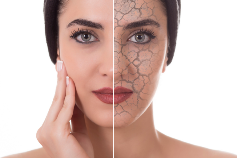 how to treat dry skin on face