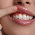 Natural Ways to Improve Gum Health