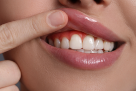 Natural Ways to Improve Gum Health