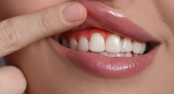 10 Proven Natural Ways to Improve Gum Health Fast (Dentist-Approved Tips!)