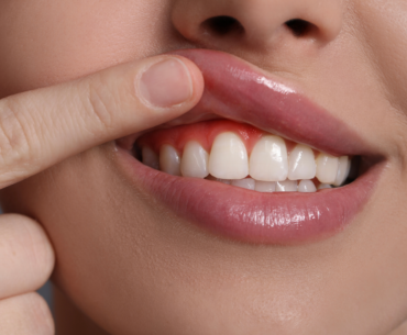 Natural Ways to Improve Gum Health